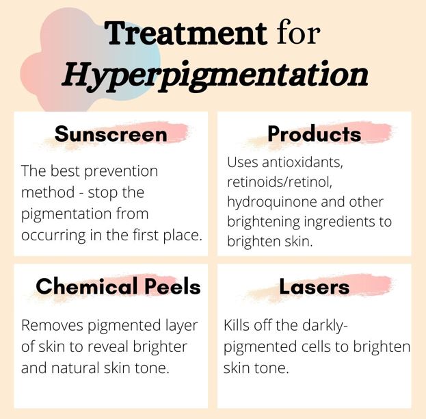 Hyperpigmentation treatment options