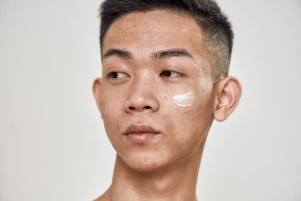 What is hyperpigmentation